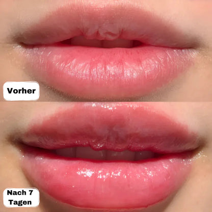 Sedki - LipBoost Set